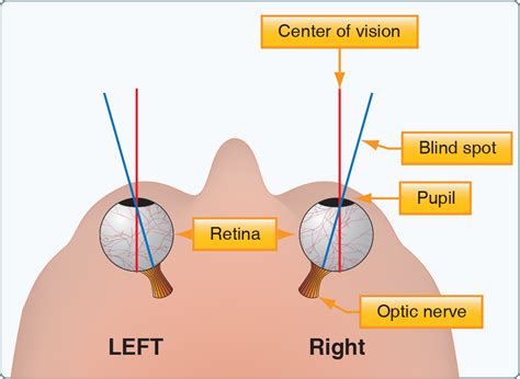 Blind Spot in Eye: Vision, Test, One Eye, Human Eye, .